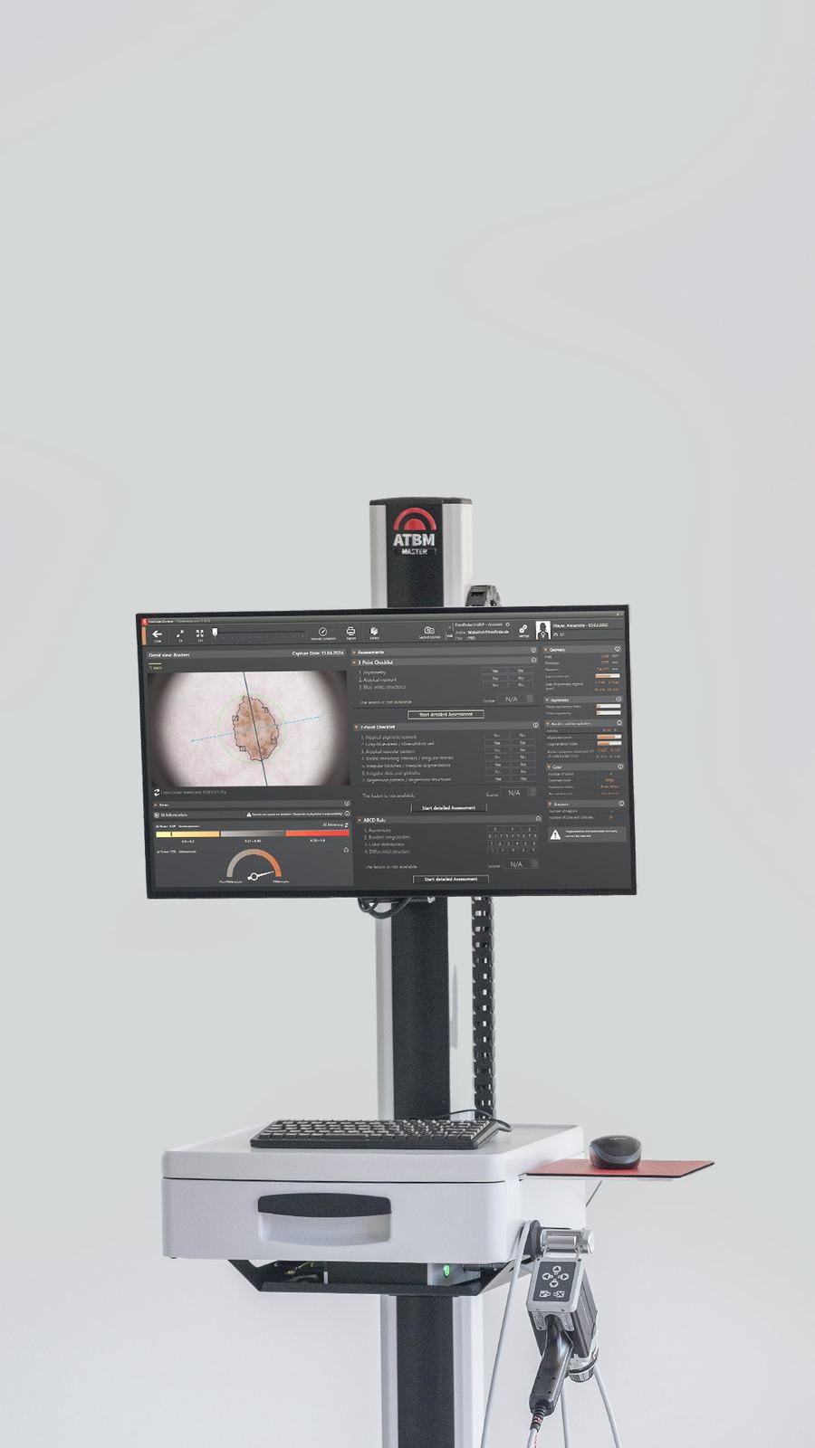 AIMEE AI for mole analysis.