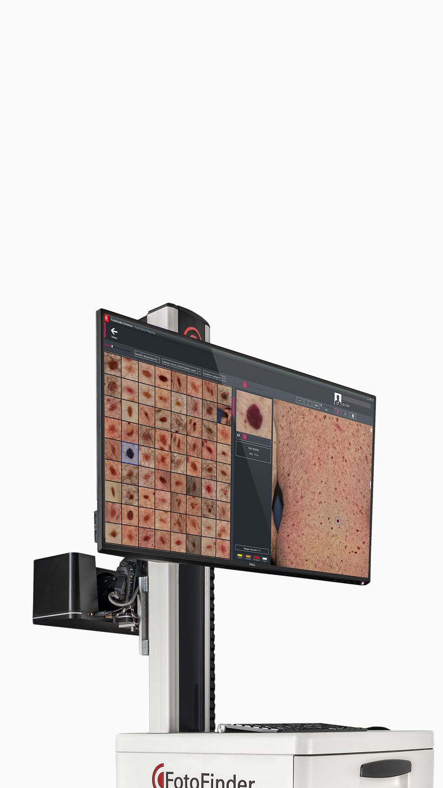 4K display Fotofinder ATBM Master.